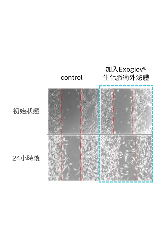 Skin fibroblast pic